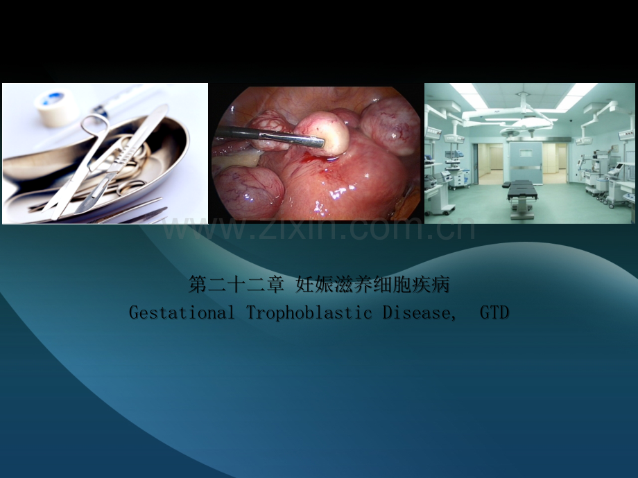 滋养细胞疾病ppt.ppt_第1页