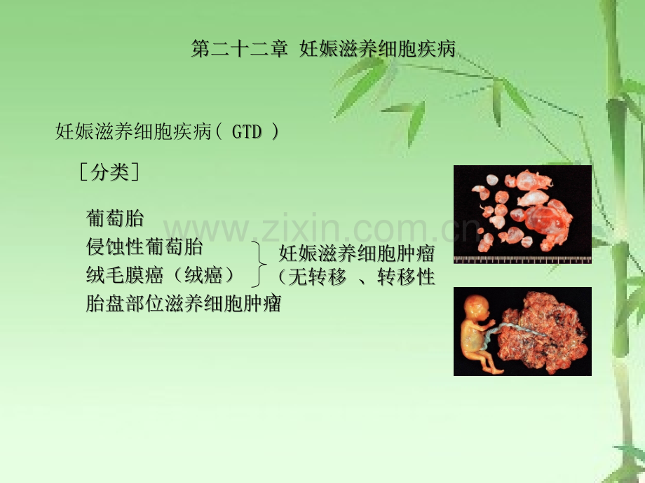 滋养细胞疾病ppt.ppt_第2页