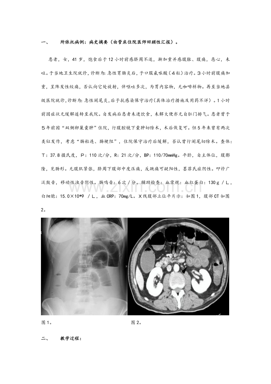 外科教学查房教案.doc_第2页