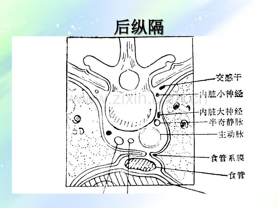 后纵隔肿瘤影像表现-PPT.ppt_第3页