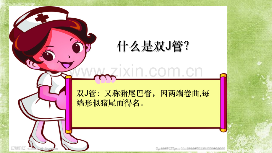 双J管的护理ppt.ppt_第3页