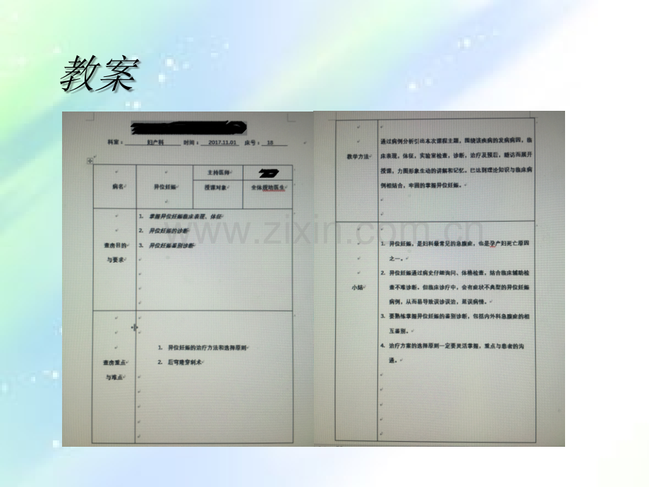 教学查房异位妊娠ppt.ppt_第2页