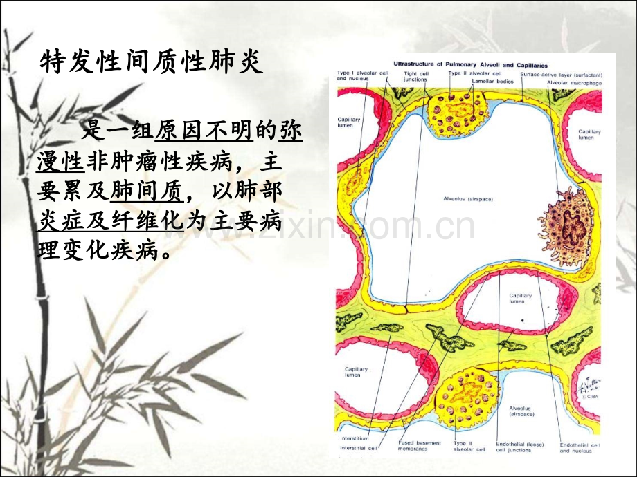 特发性间质性肺炎病理特征及分类(2015)ppt.ppt_第2页