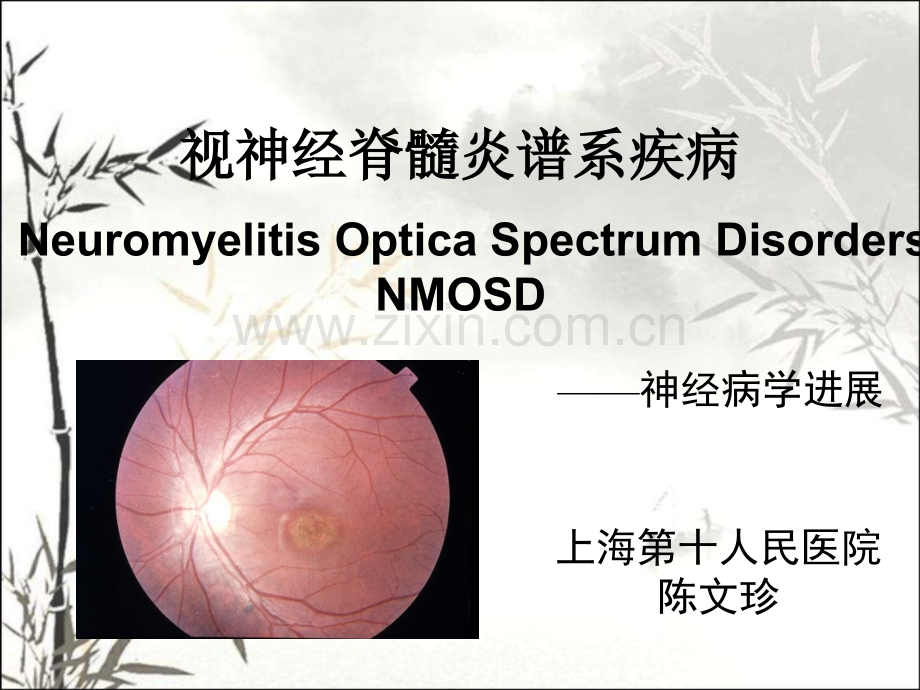 视神经脊髓炎谱系疾病ppt.ppt_第1页