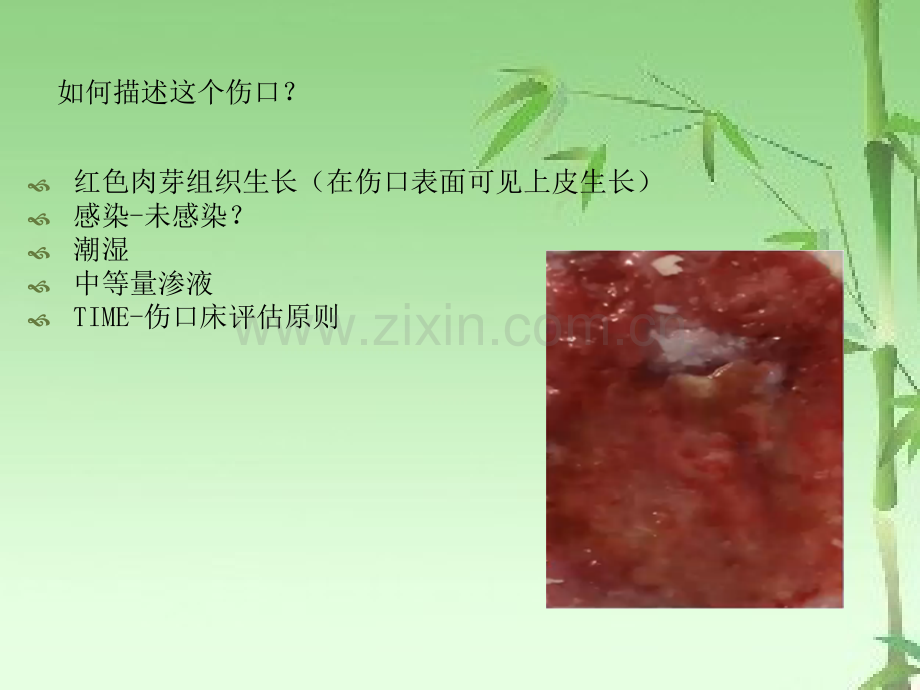 伤口评估三角临床应用ppt.ppt_第2页