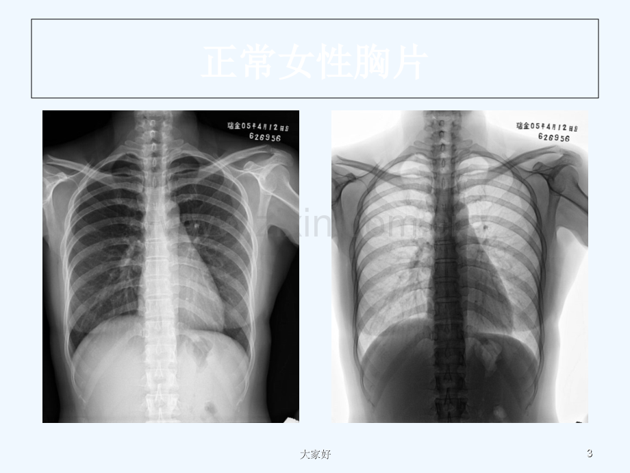 呼吸系统线应用基础-PPT.ppt_第3页