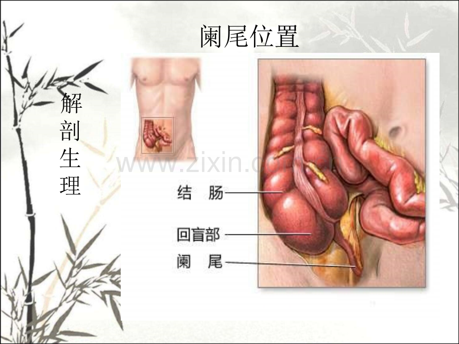 阑尾疾病课件ppt.ppt_第3页