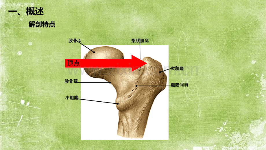 股骨粗隆间骨折-PPT.ppt_第3页