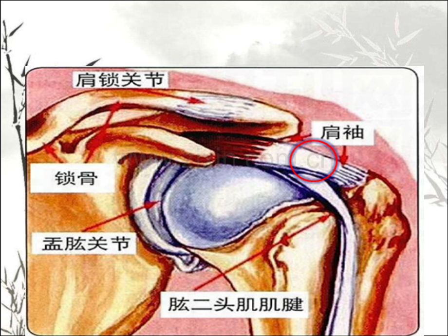 肩袖损伤的护理ppt课件.ppt_第3页