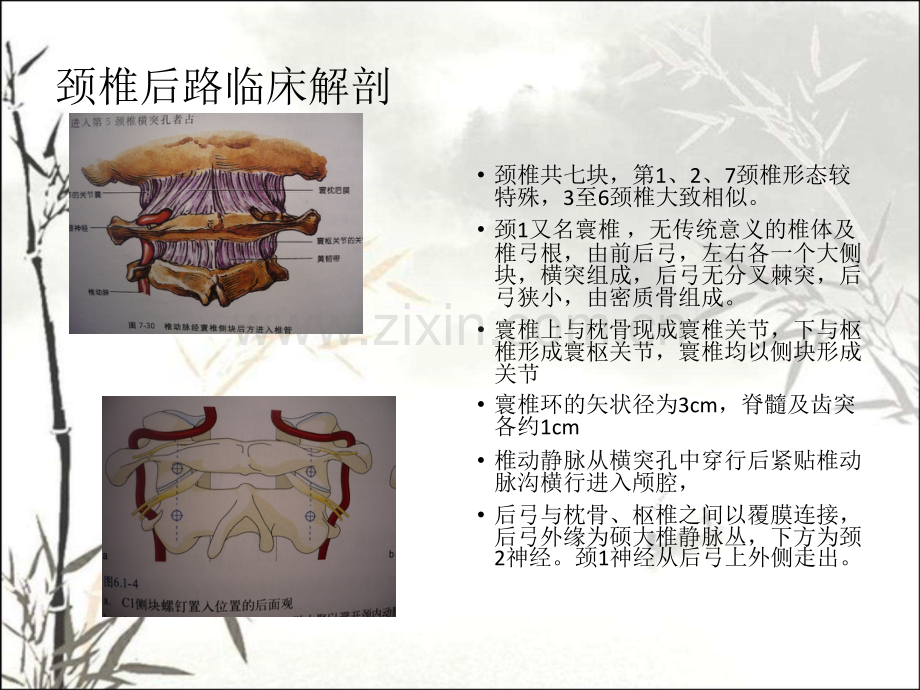 脊柱后路解剖ppt课件.ppt_第2页