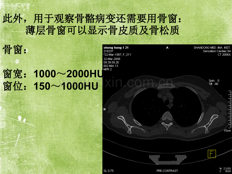 正常胸肺部CT影像学ppt.ppt_第3页