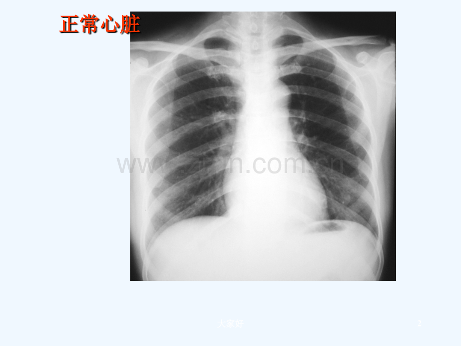 心脏常规线检查-PPT.ppt_第2页