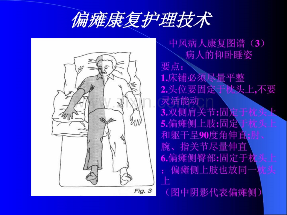 [指南]偏瘫康复图解.ppt_第2页