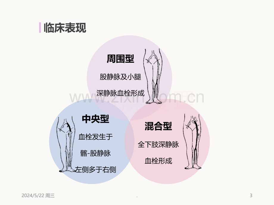 下肢深静脉血栓的护理.ppt_第3页