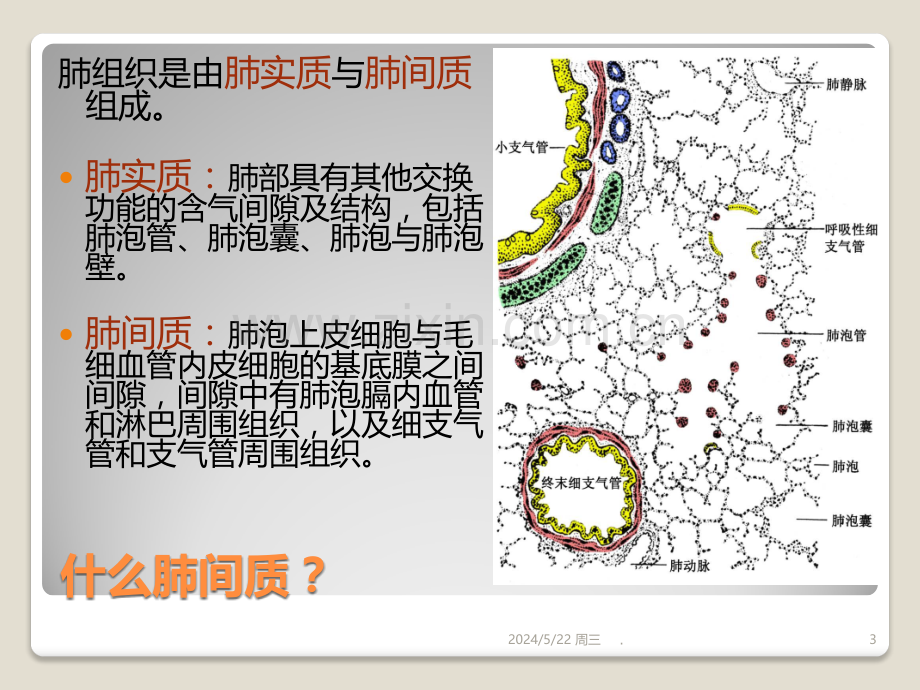 弥漫性间质性肺病-护理查房.ppt_第3页