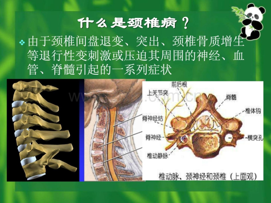 康复医学颈椎病康复.ppt_第3页