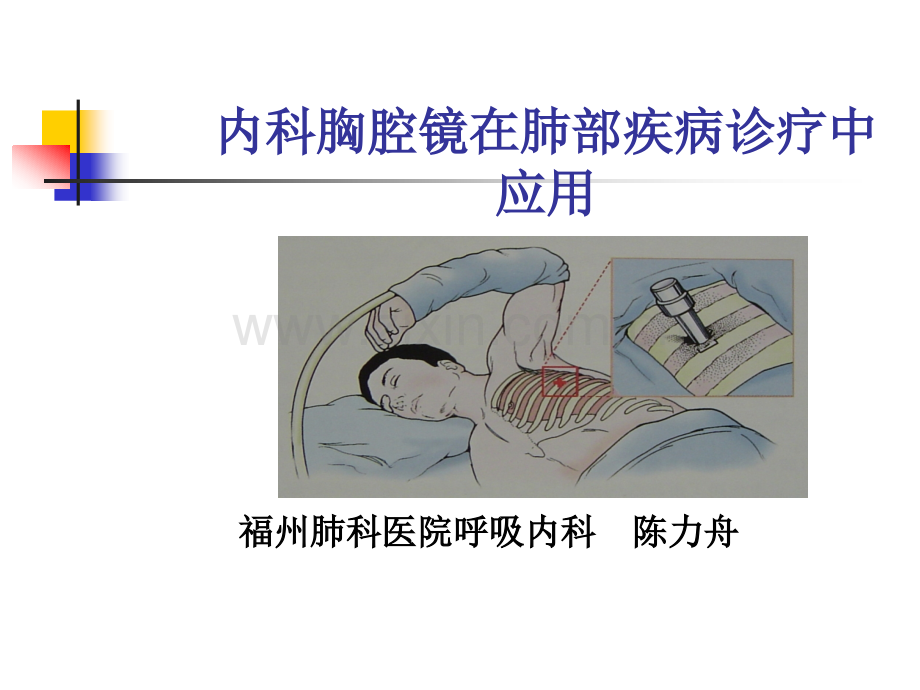 【医学】内科胸腔镜在肺部疾病诊疗中应用(81p).ppt_第1页