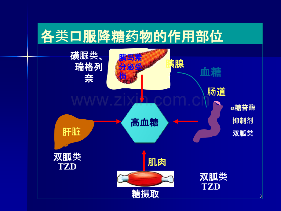 型糖尿病的口服药物治疗.ppt_第3页