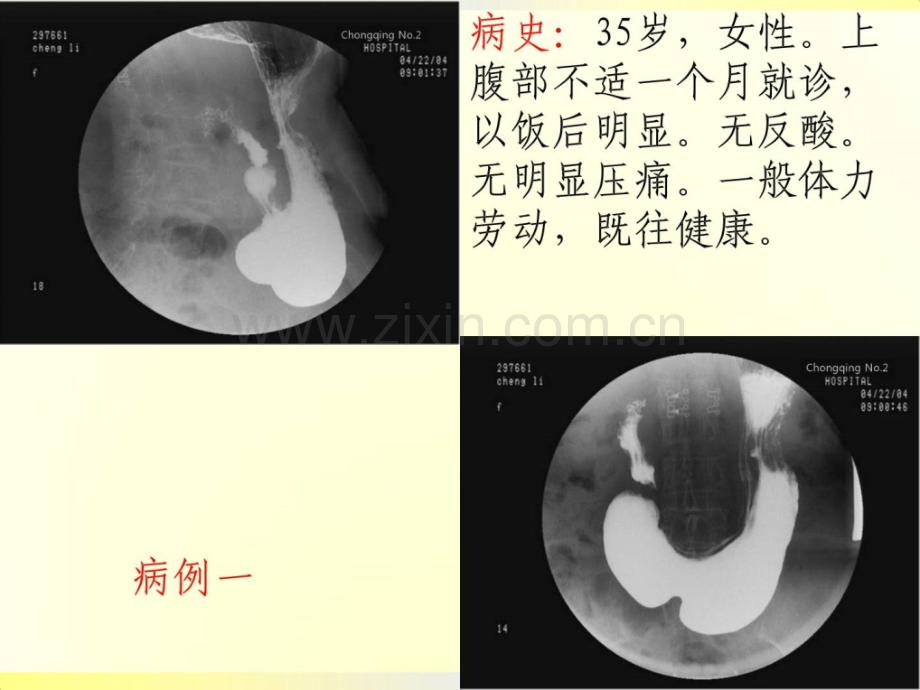 [指南]医学影像学——读片系列(消化系统练习(pbl教授教化2014上.ppt_第2页