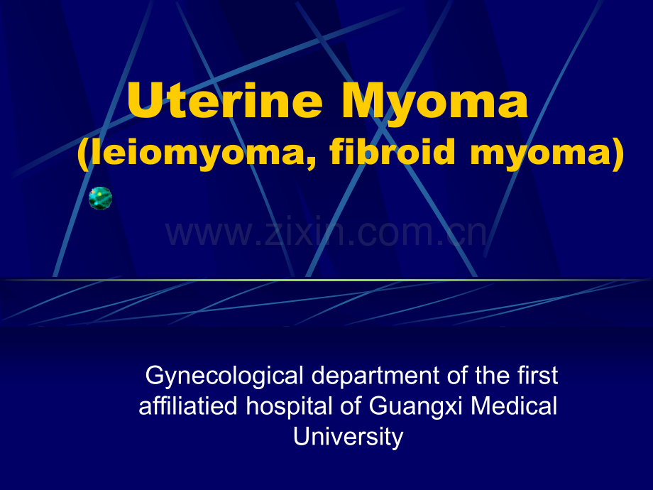 Uterinemyomas.ppt_第1页