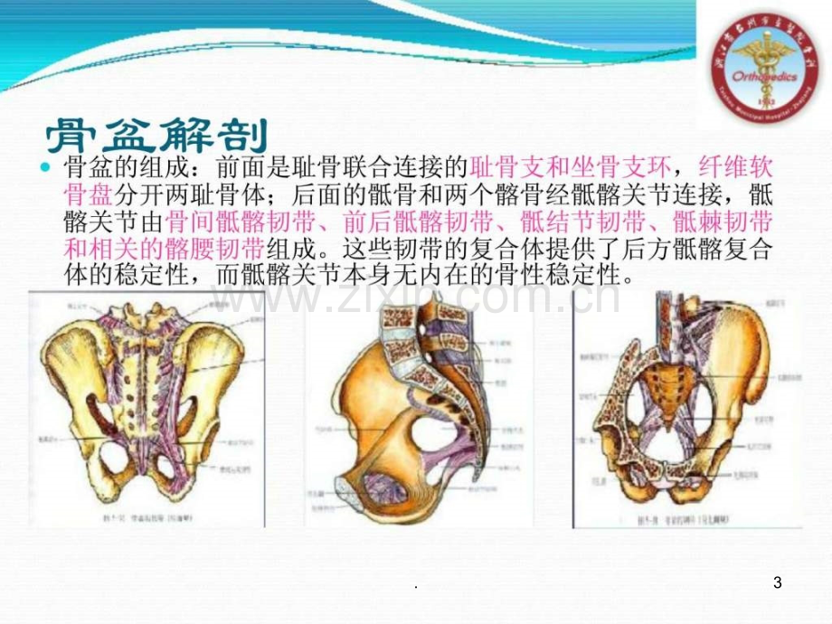 骨盆骨折的分型及治疗.ppt_第3页