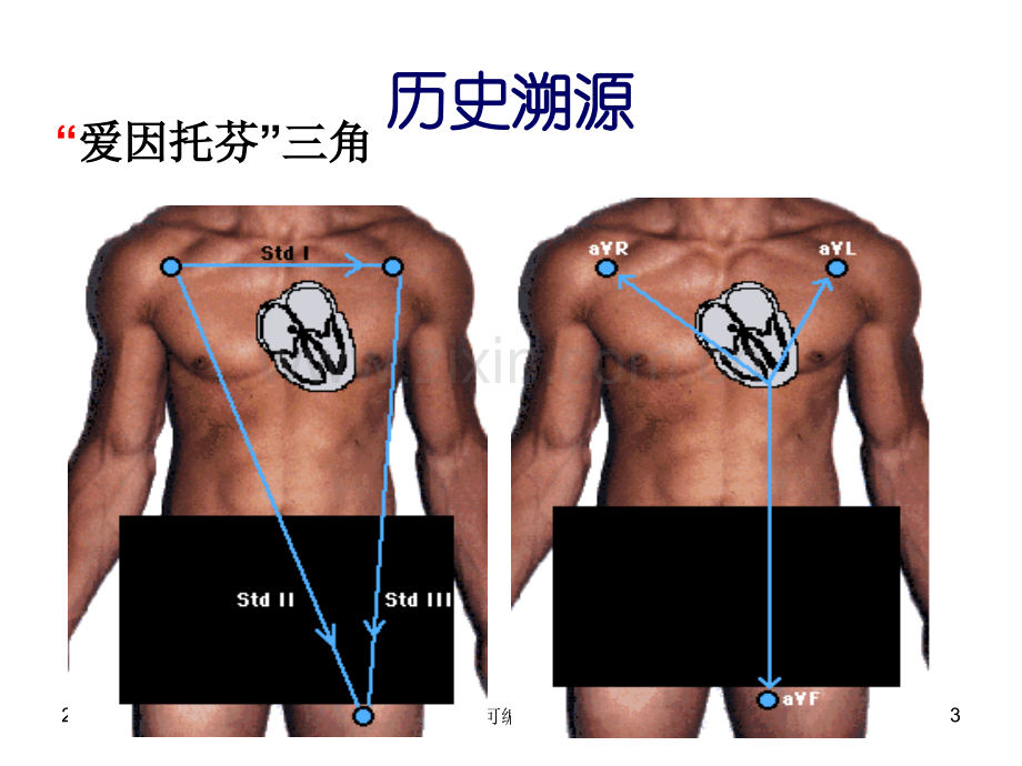 正常及异常心电图.ppt_第3页