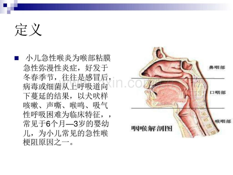 小儿急性喉炎护理.ppt_第2页