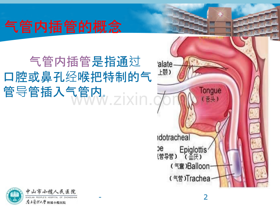 气管插管及肺隔离术.ppt_第2页