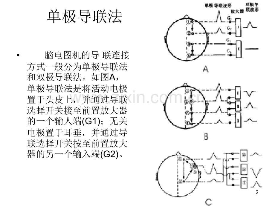 脑电图机的导联方式.ppt_第2页