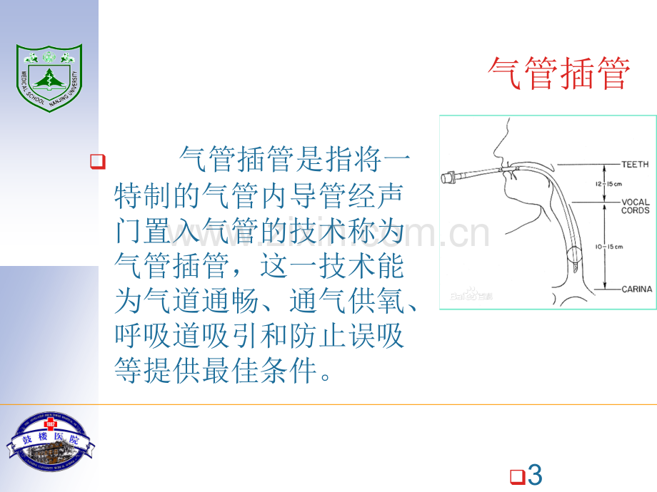 [分享]麻醉手术中气管插管术.ppt_第3页