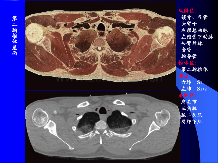 【基础医学】胸横断.ppt_第3页