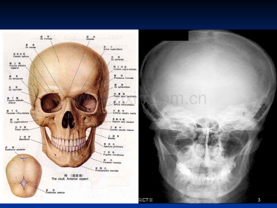 [临床医学]颜面部影像解剖学.ppt_第3页
