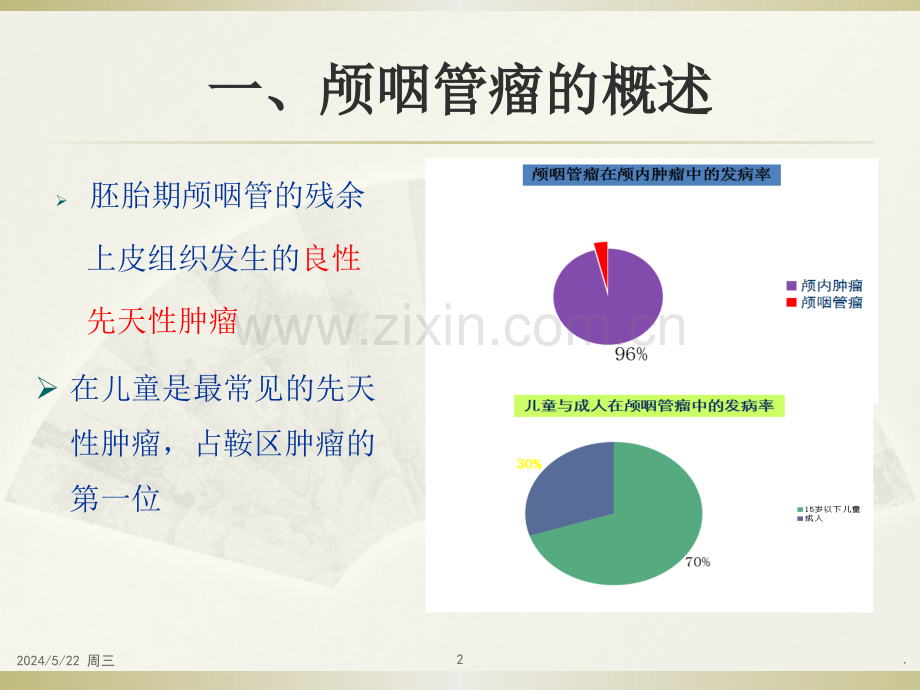 颅咽管瘤围手术期护理.ppt_第2页