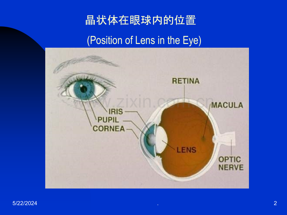 白-内-障-病-人-护-理.ppt_第2页