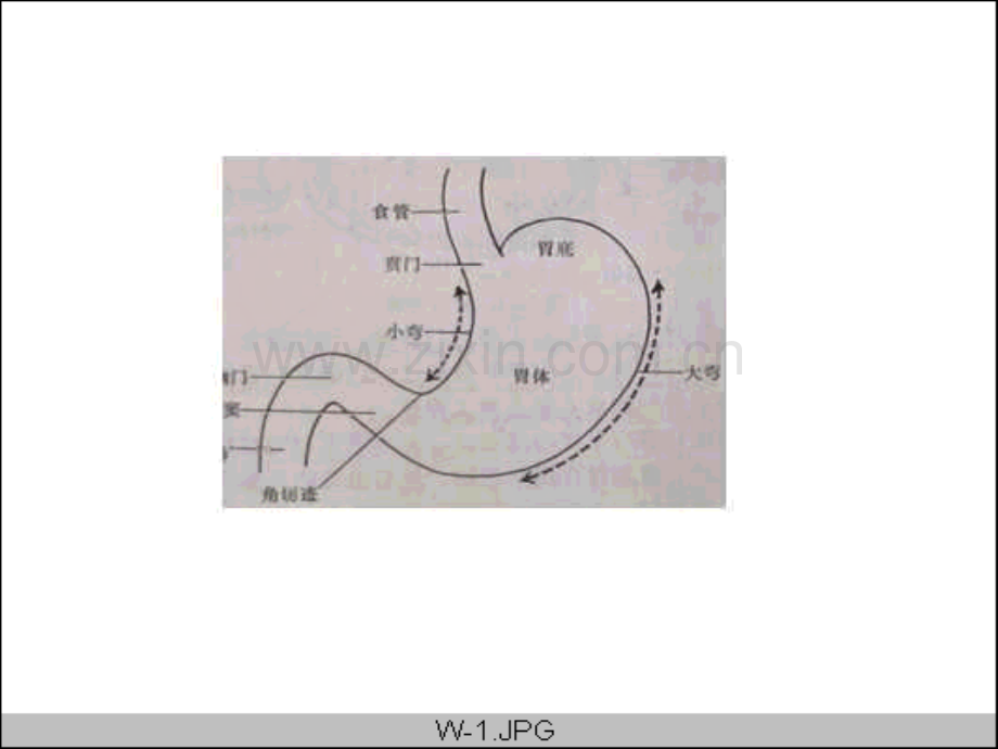 【临床医学】胃12指肠疾病.ppt_第3页