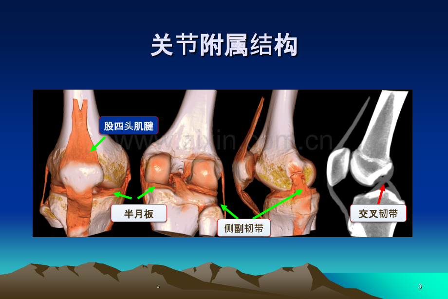 关节置换的康复(髋关节).ppt_第3页