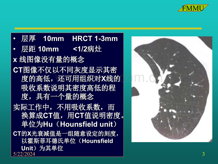 [临床医学]CT读片胸部.ppt_第3页