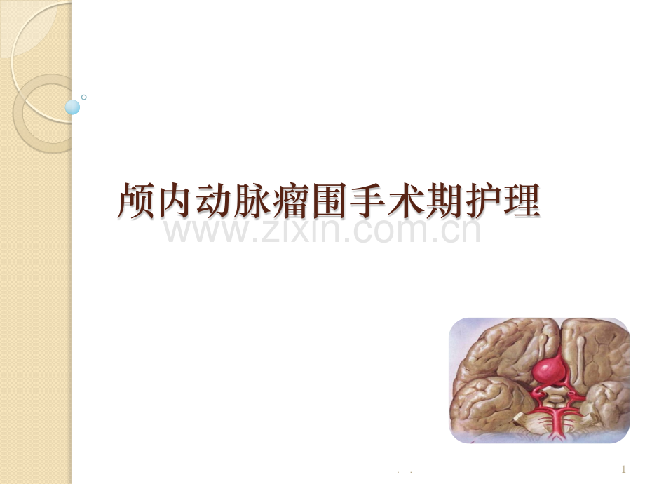 颅内动脉瘤围手术期护理.ppt_第1页