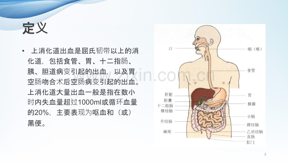 上消化道大出血的急救护理.pptx_第3页