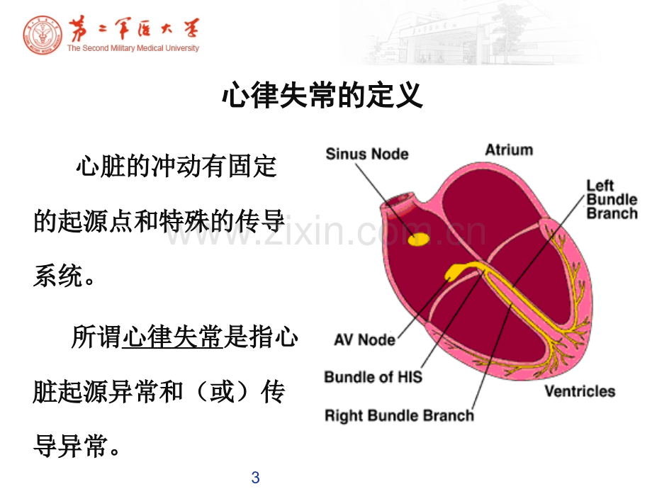 心律失常心电图.ppt_第3页