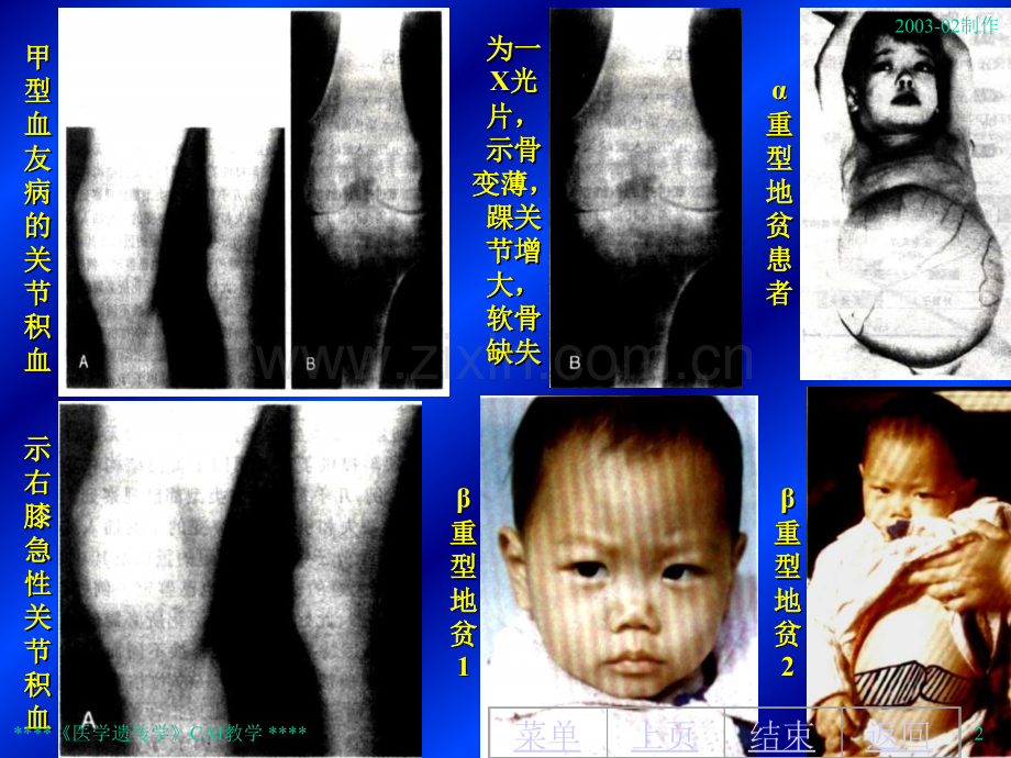 【基础医学】第九章生化遗传学.ppt_第2页