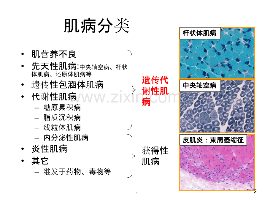 方琪-遗传性肌肉疾病的诊断方法和策略.ppt_第2页