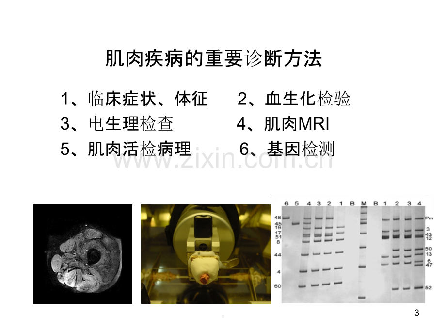 方琪-遗传性肌肉疾病的诊断方法和策略.ppt_第3页