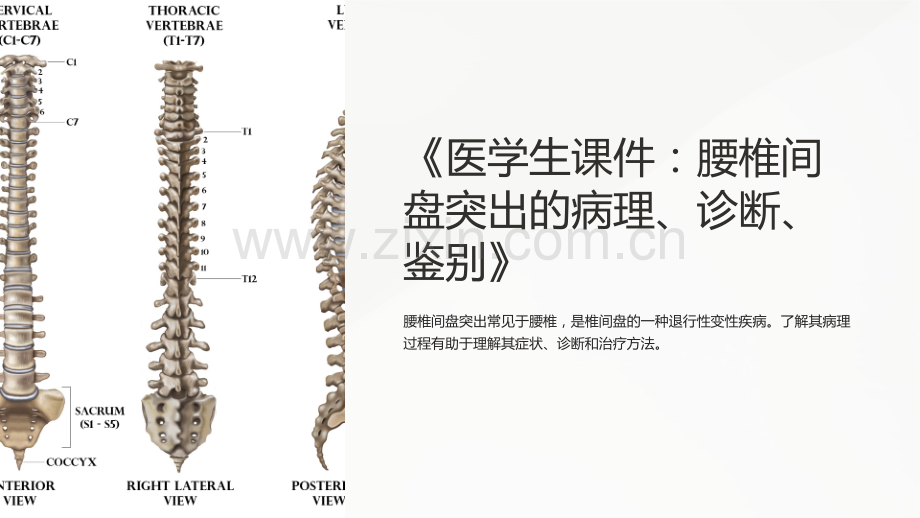 《医学生课件：腰椎间盘突出的病理、诊断、鉴别》.ppt_第1页