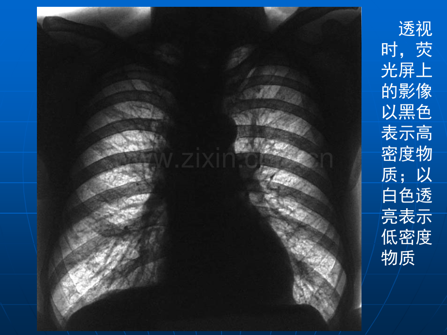 胸部影像学基础知识.ppt_第3页