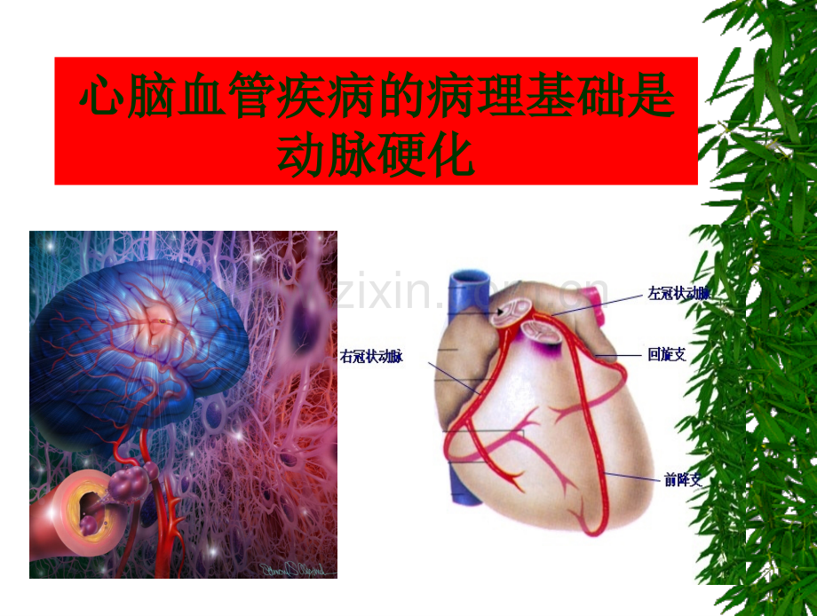 心脑血管与管壁通1015.ppt_第3页