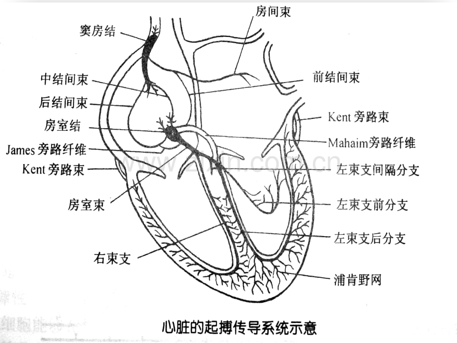 临时起搏器的护理-9床.ppt_第2页