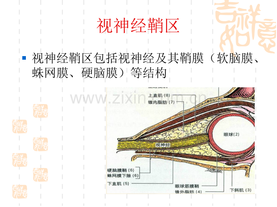 视神经鞘脑膜瘤的影像诊断.ppt_第2页