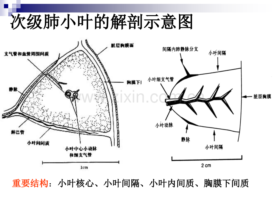 肺部间质病的基本病变影像.ppt_第2页