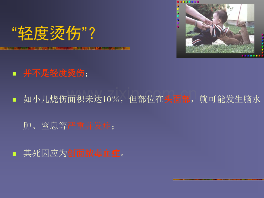 小儿烧伤讲座.ppt_第3页